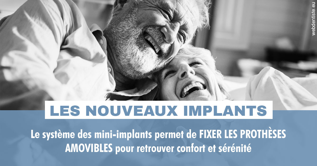 https://dr-emmanuel-toucas.chirurgiens-dentistes.fr/Les nouveaux implants 2