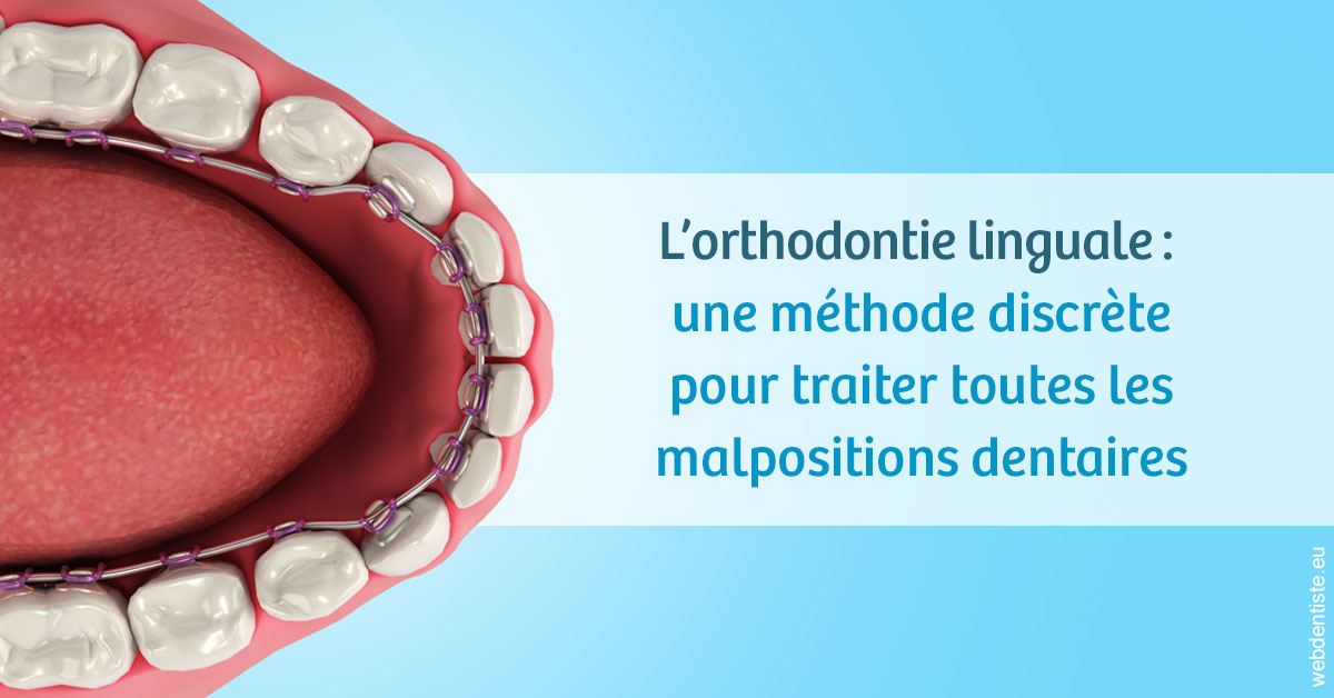 https://dr-emmanuel-toucas.chirurgiens-dentistes.fr/L'orthodontie linguale 1