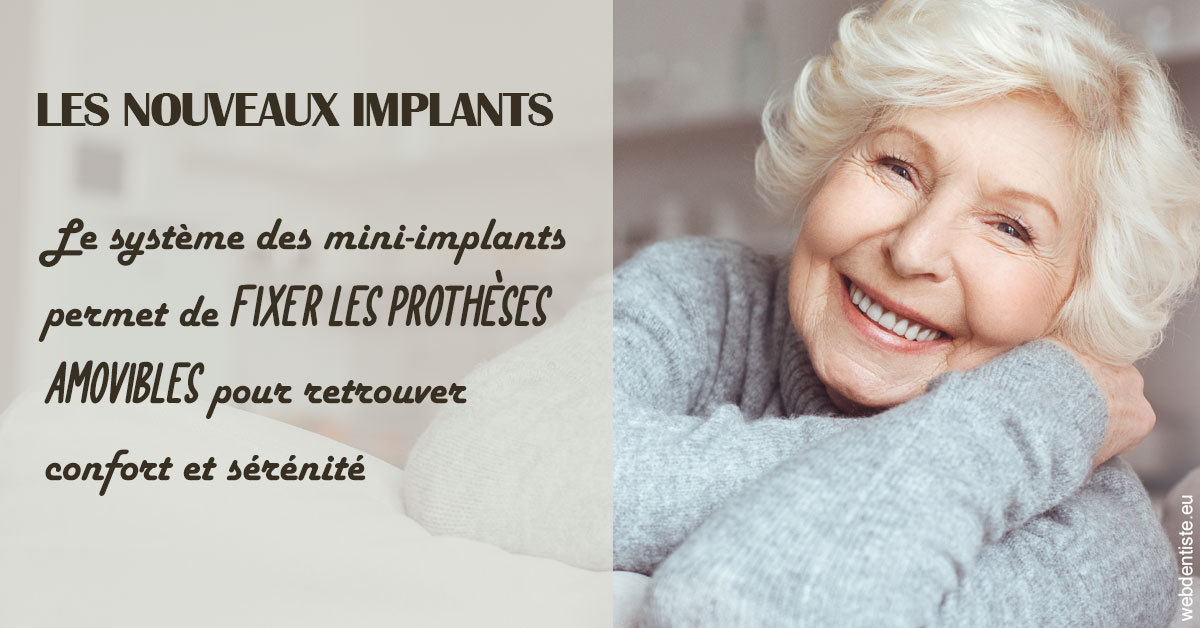 https://dr-emmanuel-toucas.chirurgiens-dentistes.fr/Les nouveaux implants 1