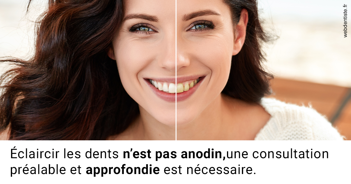 https://dr-emmanuel-toucas.chirurgiens-dentistes.fr/Le blanchiment 2