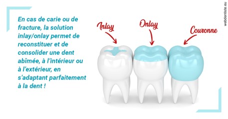 https://dr-emmanuel-toucas.chirurgiens-dentistes.fr/L'INLAY ou l'ONLAY