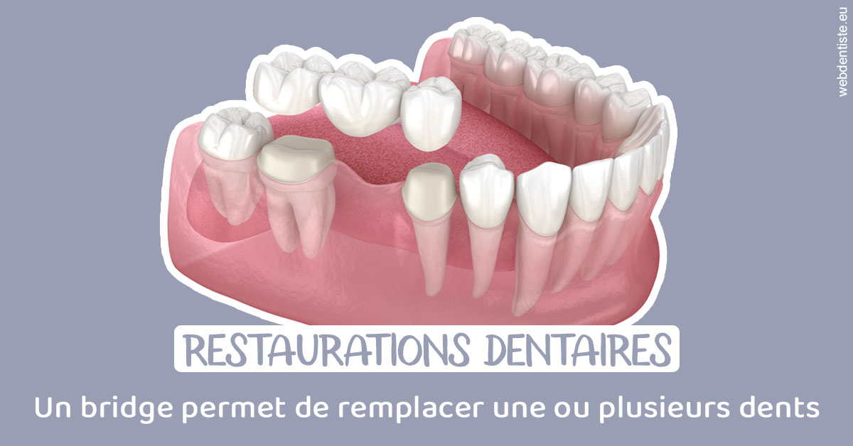 https://dr-emmanuel-toucas.chirurgiens-dentistes.fr/Bridge remplacer dents 1