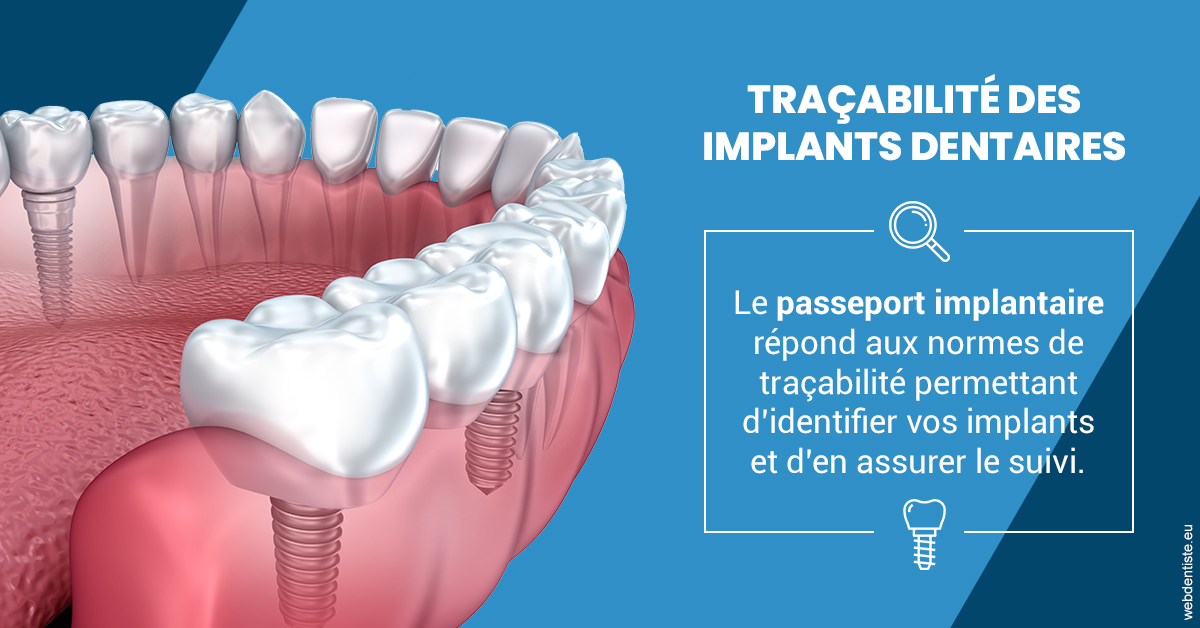 https://dr-emmanuel-toucas.chirurgiens-dentistes.fr/T2 2023 - Traçabilité des implants 1