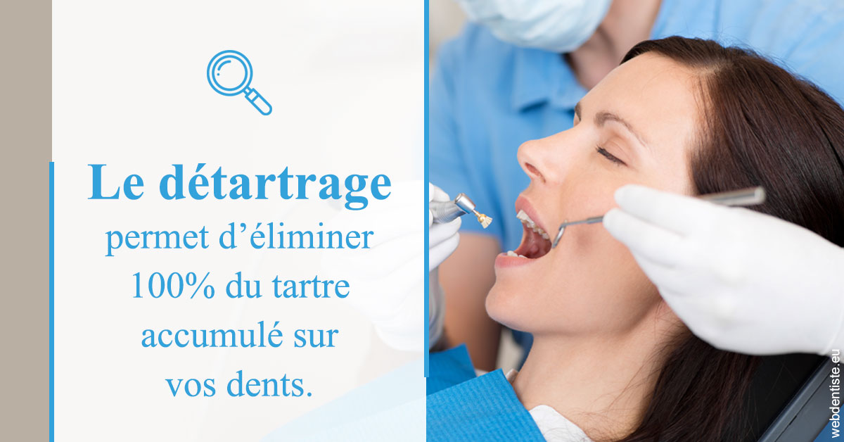 https://dr-emmanuel-toucas.chirurgiens-dentistes.fr/En quoi consiste le détartrage
