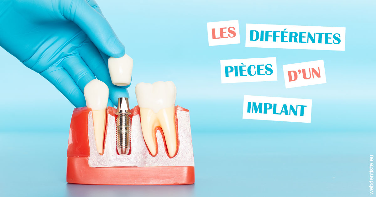 https://dr-emmanuel-toucas.chirurgiens-dentistes.fr/Les différentes pièces d’un implant 2