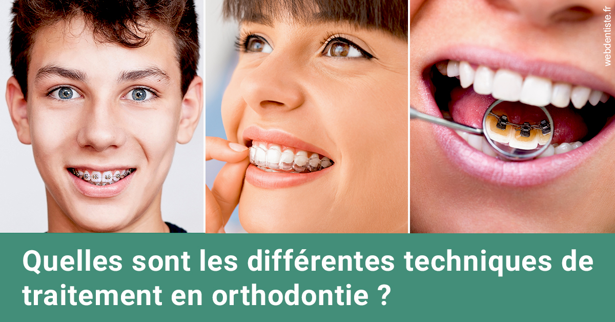 https://dr-emmanuel-toucas.chirurgiens-dentistes.fr/Les différentes techniques de traitement 2