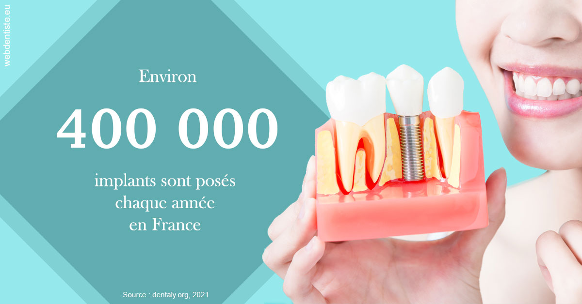 https://dr-emmanuel-toucas.chirurgiens-dentistes.fr/Pose d'implants en France 2