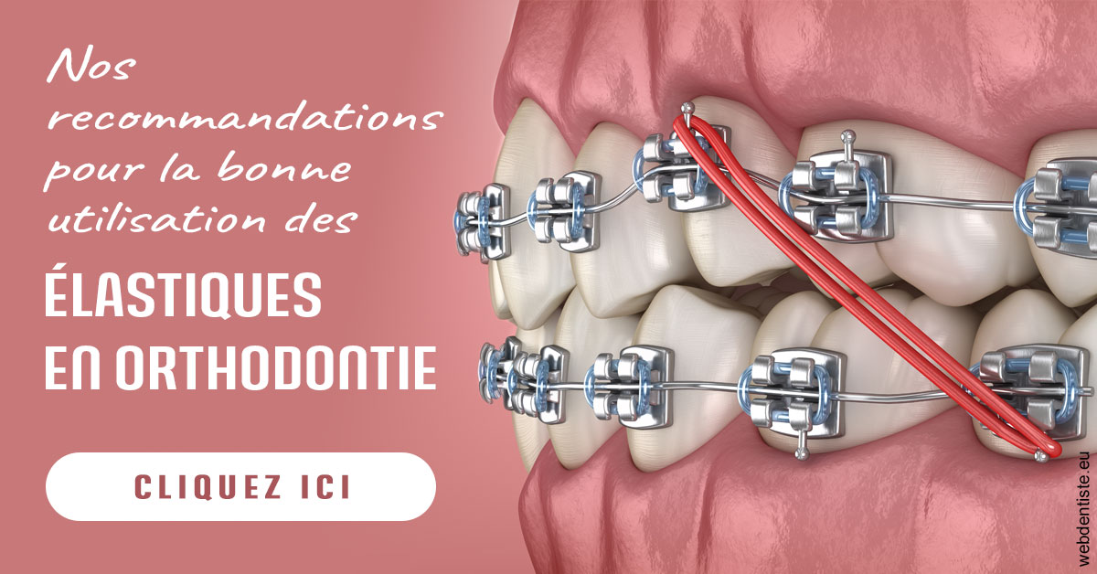 https://dr-emmanuel-toucas.chirurgiens-dentistes.fr/Elastiques orthodontie 2